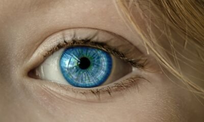 Conjunctivitis