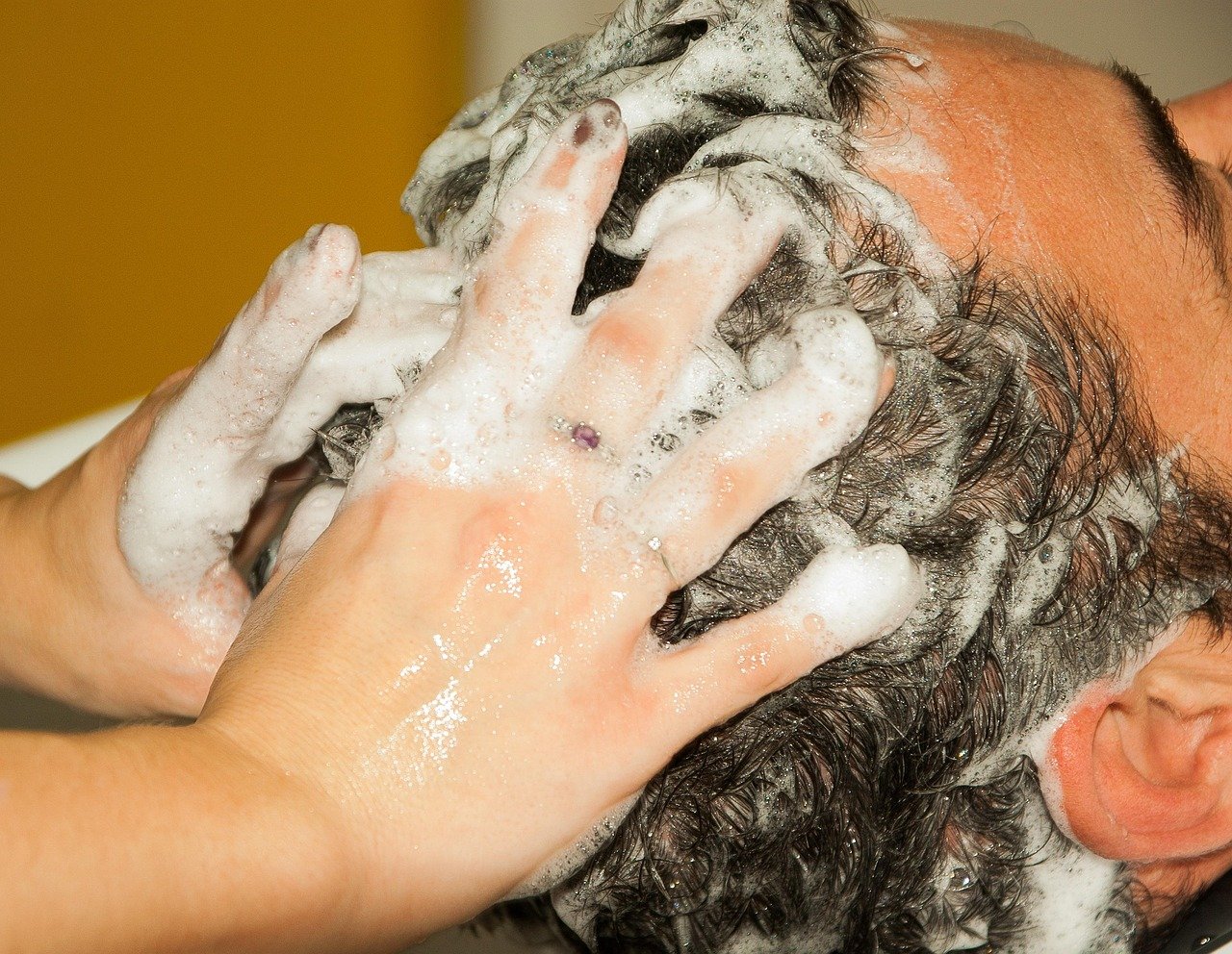 Dandruff (Sikri) - hairdresser, shampoo
