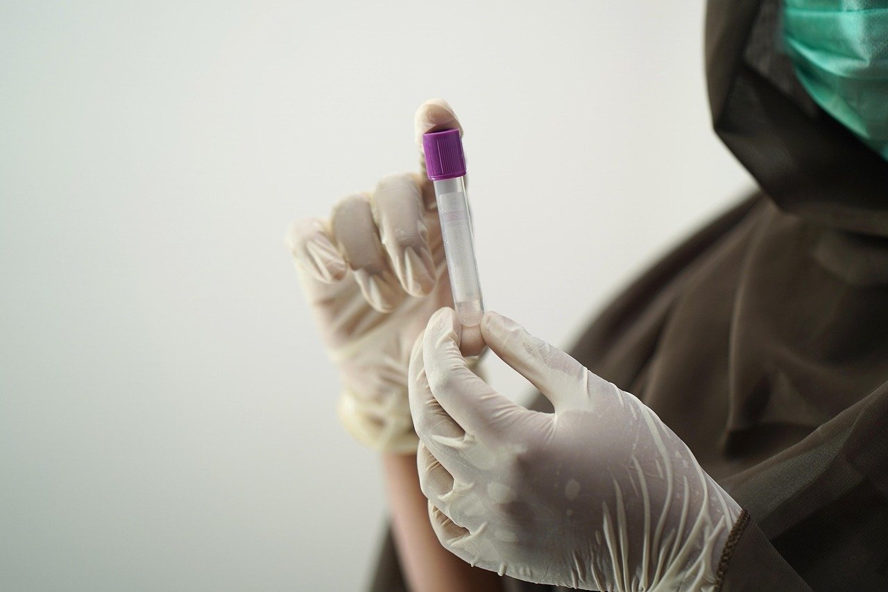 Hepatitis C in Pakistan - blood test, blood sample