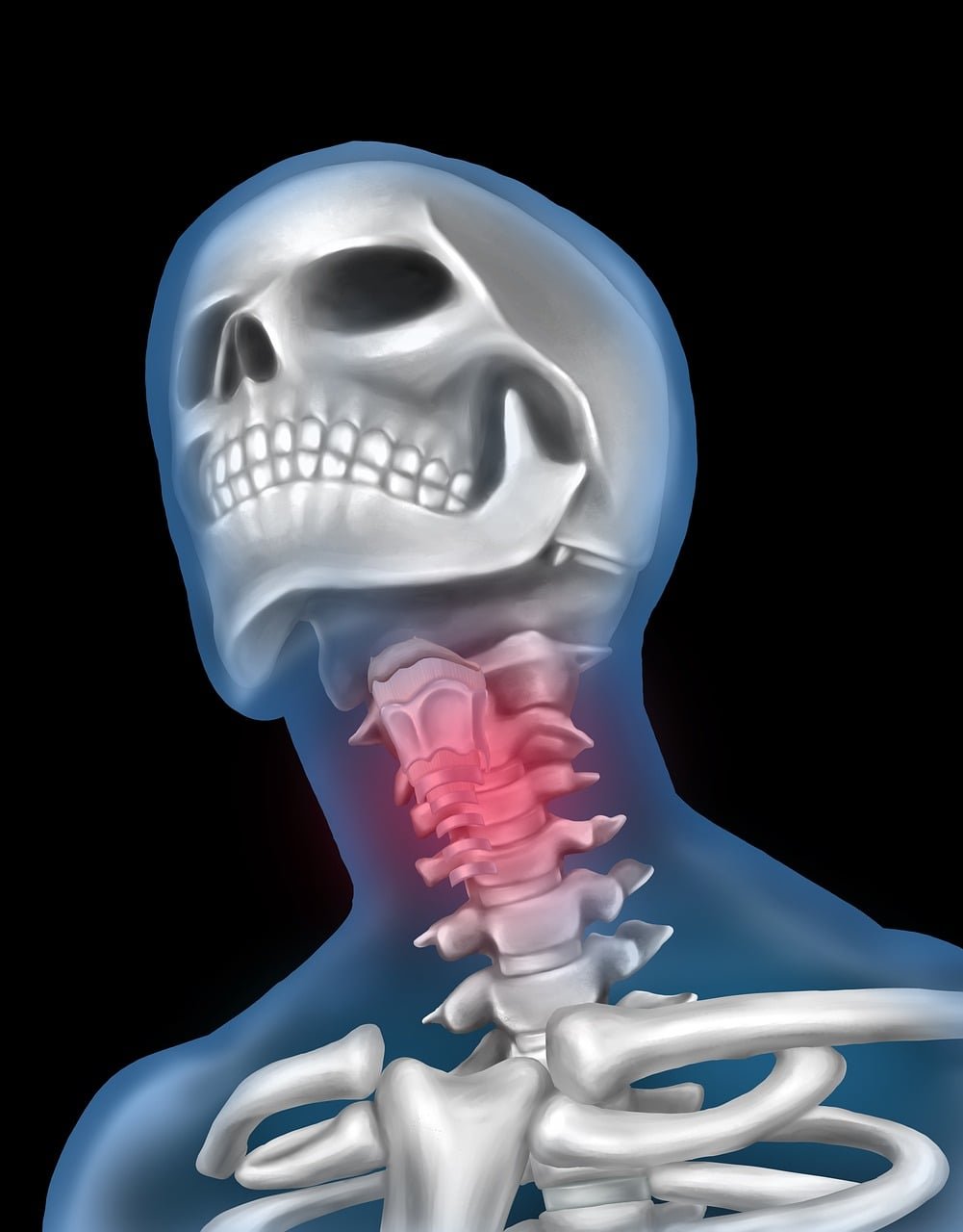Tonsillitis and Sore Throat - sore throat, neck pain