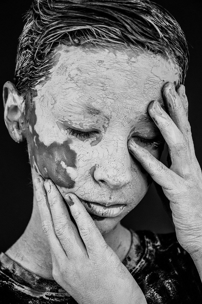 Vitiligo (Safaid Daagh) - skin, cracks