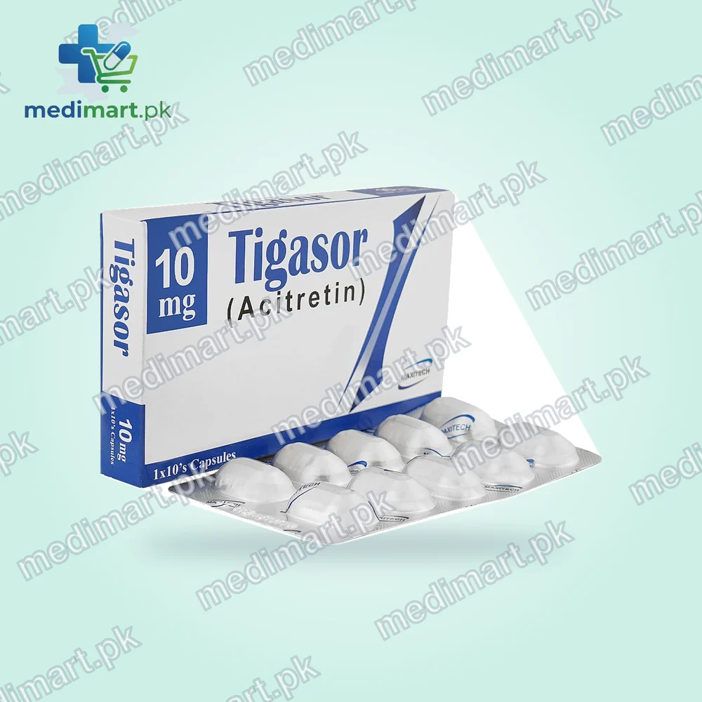Tigasor 10mg Capsule Tigasor 10mg Capsule