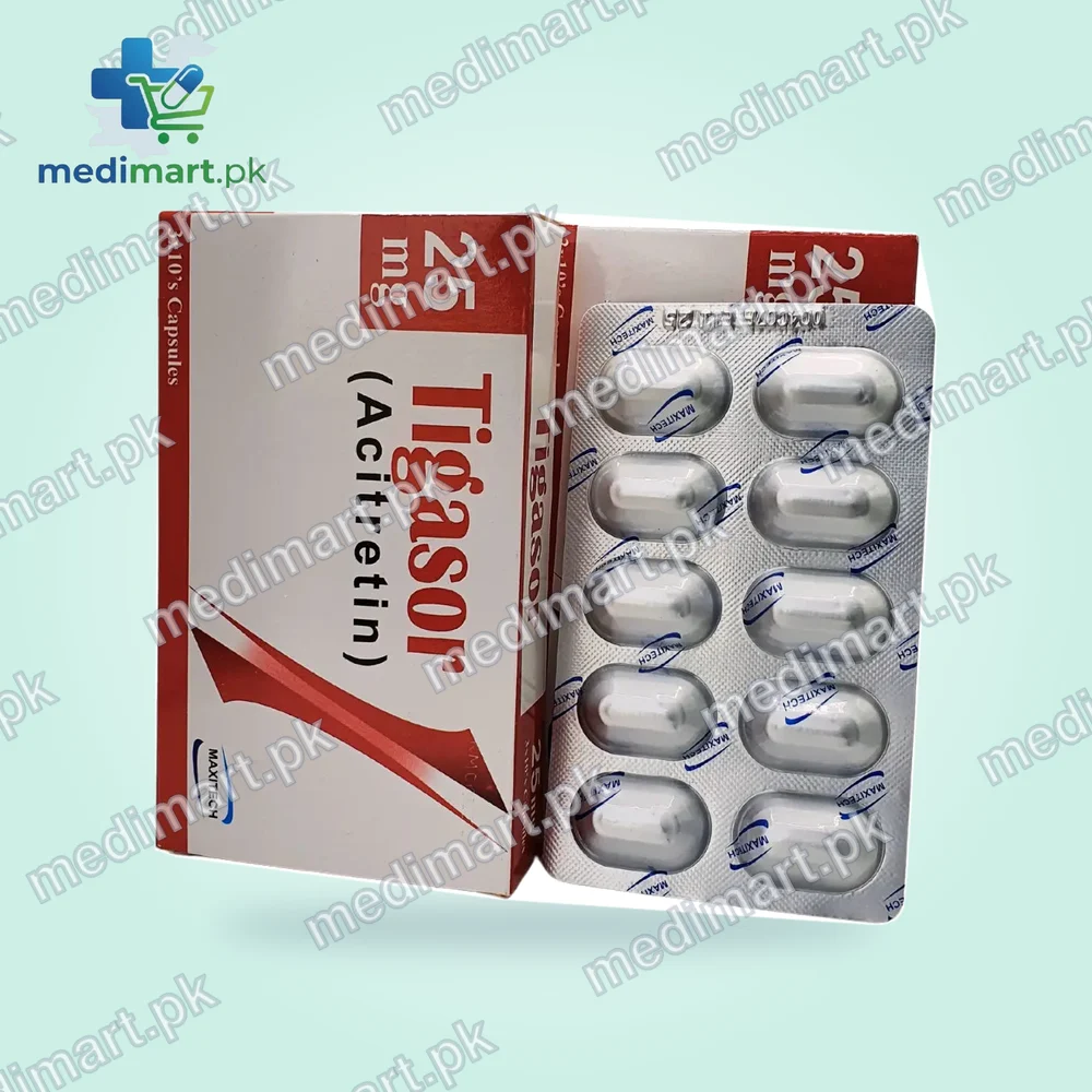 Tigasor 25mg Capsule Tigasor 25mg Capsule